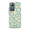 Emile Mint - Xiaomi 12 / 12x